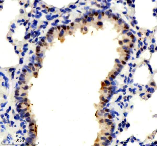 IHC analysis of TP73 using anti-TP73 antibody (M00688)