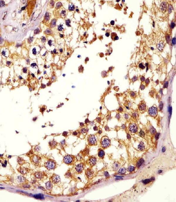 m00689 anti kiss1 antibody n term ihc p testing 4
