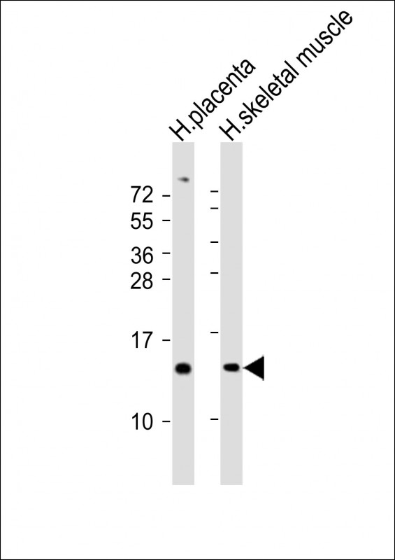 All lanes : Anti-KISS1 Antibody (N-Term) at 1:2000 dilutionLane 1: human placenta lysatesLane 2: human skeletal muscle lysatesLysates/proteins at 20 µg per lane