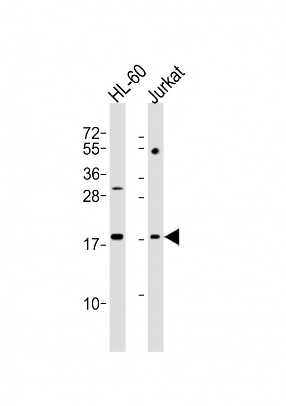 All lanes : Anti-KISS1 Antibody (N-Term) at 1:2000 dilutionLane 1: HL-60 whole cell lysatesLane 2: Jurkat whole cell lysatesLysates/proteins at 20 µg per lane