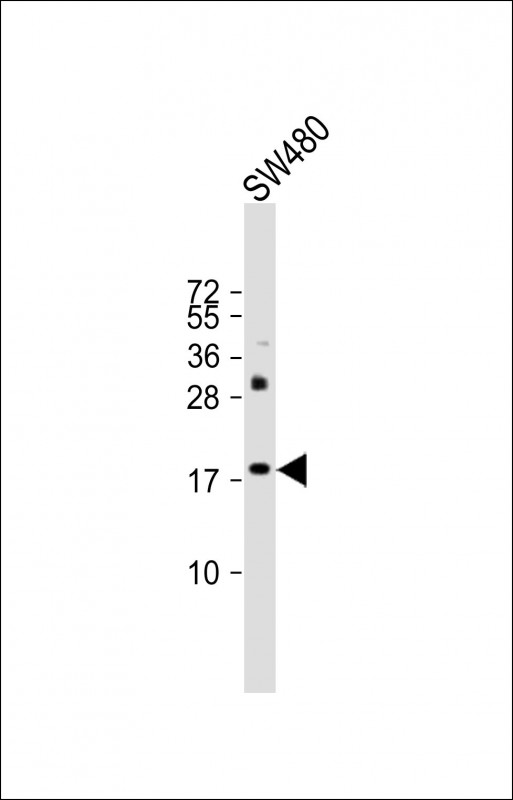 Anti-KISS1 Antibody (N-Term)at 1:500 dilution + SW480 whole cell lysatesLysates/proteins at 20 µg per lane