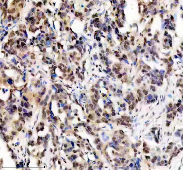 IHC analysis of ERCC2 using anti-ERCC2 antibody (M00694-1)