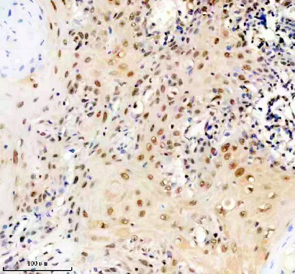 IHC analysis of ERCC2 using anti-ERCC2 antibody (M00694-1)