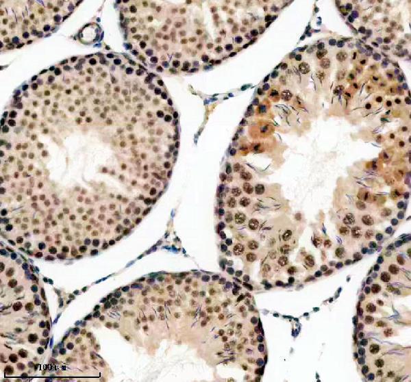 m00694 1 ercc2 primary antibodies ihc testing 4