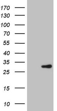 Human recombinant protein fragment corresponding to amino acids 78-307 of human ERCC2 (NP_000391) produced in E