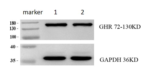 Western blot analysis of BDNF using anti-GHR antibody (M00698-1)