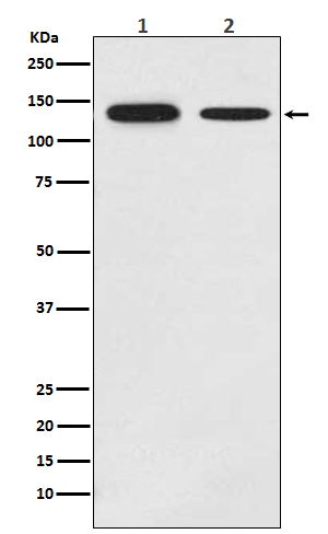 Western blot analysis of Growth hormone receptor expression in (1) MCF-7 cell lysate; (2) Mouse brain lysate