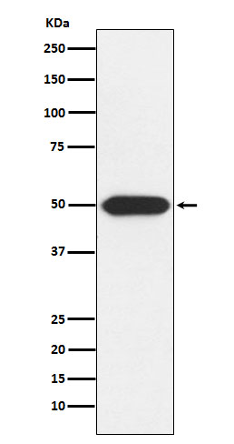 Western blot analysis of Protein Kinase A regulatory subunit I alpha expression in U-87MG cell lysate