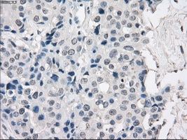 m00699 anti protein kinase a regulatory subunit i alpha prkar1a mouse monoclonal antibody clone id oti6c7 ihc testing 10