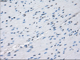 m00699 anti protein kinase a regulatory subunit i alpha prkar1a mouse monoclonal antibody clone id oti6c7 ihc testing 11