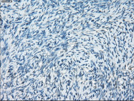m00699 anti protein kinase a regulatory subunit i alpha prkar1a mouse monoclonal antibody clone id oti6c7 ihc testing 5