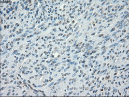 m00699 anti protein kinase a regulatory subunit i alpha prkar1a mouse monoclonal antibody clone id oti6c7 ihc testing 6