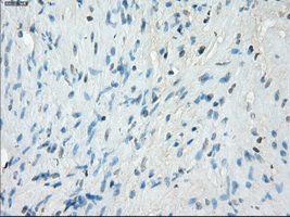 m00699 anti protein kinase a regulatory subunit i alpha prkar1a mouse monoclonal antibody clone id oti6c7 ihc testing 7