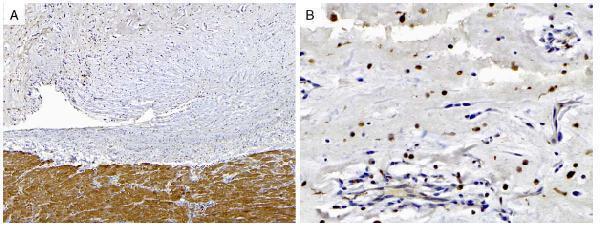 m00699 anti protein kinase a regulatory subunit i alpha prkar1a mouse monoclonal antibody clone id oti6c7 ihc testing 8