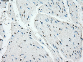 m00699 anti protein kinase a regulatory subunit i alpha prkar1a mouse monoclonal antibody clone id oti6c7 ihc testing 9