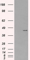 HEK293T cells were transfected with the pCMV6-ENTRY control (Left lane) or pCMV6-ENTRY PRKAR1A (Right lane) cDNA for 48 hrs and lysed