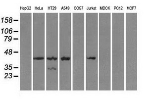 Western blot analysis of extracts (35ug) from 9 different cell lines by using anti-PRKAR1A monoclonal antibody