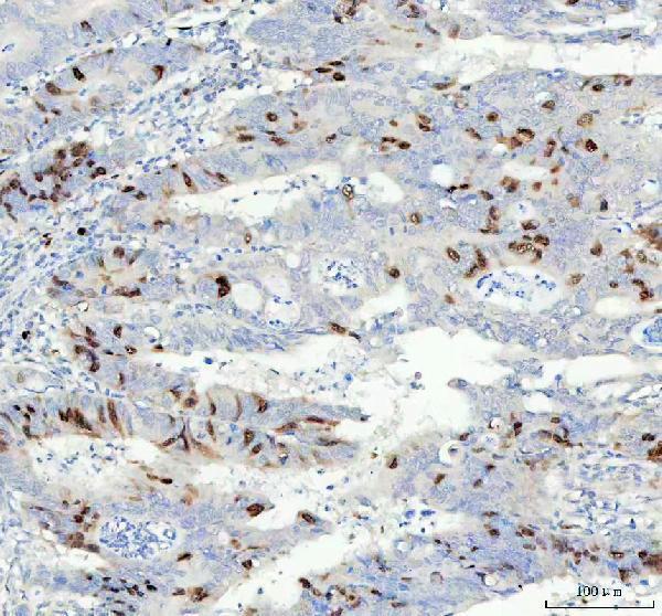  IHC analysis of Cyclin A2 using anti-Cyclin A2 antibody (M00700-1)
