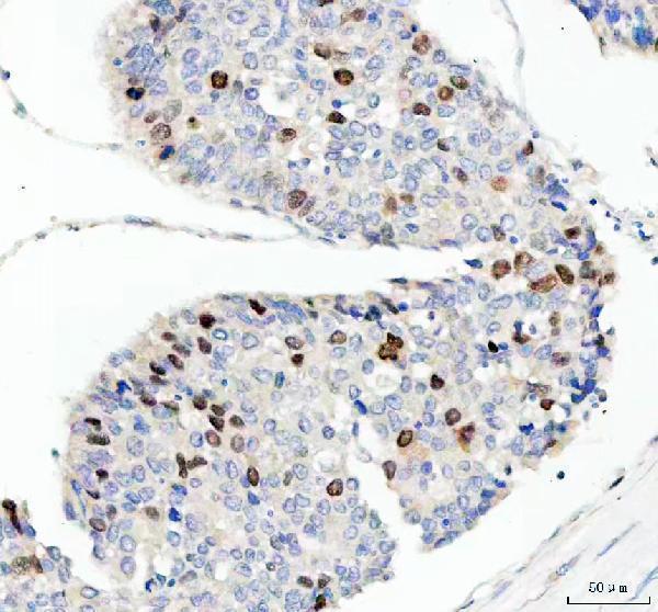  IHC analysis of Cyclin A2 using anti-Cyclin A2 antibody (M00700-1)