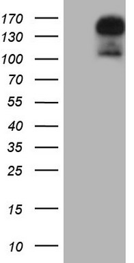 HEK293T cells were transfected with the pCMV6-ENTRY control (Left lane) or pCMV6-ENTRY GLI2 (Right lane) cDNA for 48 hrs and lysed