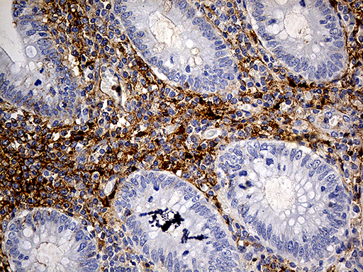 Immunohistochemical staining of paraffin-embedded Human appendix tissue within the normal limits using anti-PLG mouse monoclonal antibody
