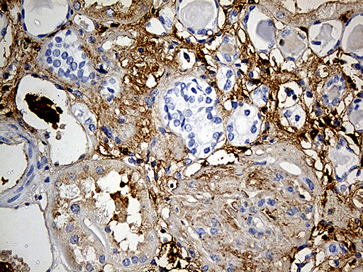 Immunohistochemical staining of paraffin-embedded Human Kidney tissue within the normal limits using anti-PLG mouse monoclonal antibody