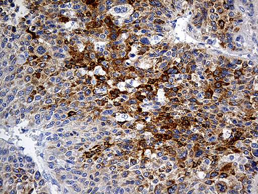 m00702 anti plasminogen plg mouse monoclonal antibody clone id oti4f5 ihc testing 5