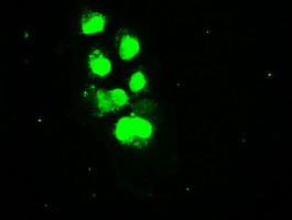 m00705 1 anti ssb mouse monoclonal antibody clone id oti1e11 if testing 6