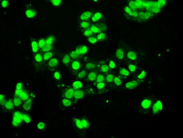 m00705 1 anti ssb mouse monoclonal antibody clone id oti1e11 if testing 7
