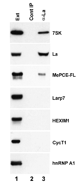 m00705 1 anti ssb mouse monoclonal antibody clone id oti1e11 ip testing 9
