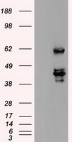 m00705 1 anti ssb mouse monoclonal antibody clone id oti1e11 wb testing 1