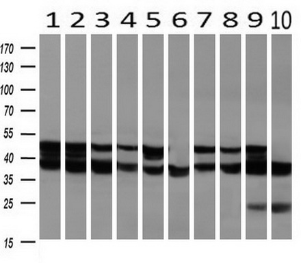 m00705 1 anti ssb mouse monoclonal antibody clone id oti1e11 wb testing 2