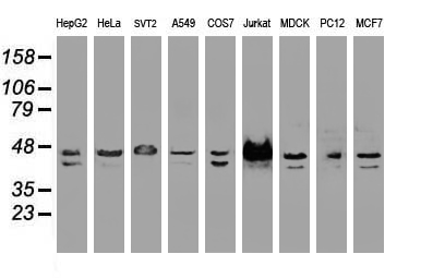 m00705 1 anti ssb mouse monoclonal antibody clone id oti1e11 wb testing 3