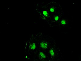 m00705 2 anti ssb mouse monoclonal antibody clone id oti2c8 if testing 15