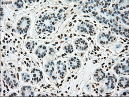 m00705 2 anti ssb mouse monoclonal antibody clone id oti2c8 ihc testing 10