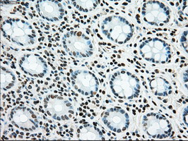m00705 2 anti ssb mouse monoclonal antibody clone id oti2c8 ihc testing 11