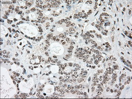 m00705 2 anti ssb mouse monoclonal antibody clone id oti2c8 ihc testing 12