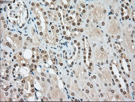 m00705 2 anti ssb mouse monoclonal antibody clone id oti2c8 ihc testing 13