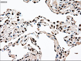 m00705 2 anti ssb mouse monoclonal antibody clone id oti2c8 ihc testing 14