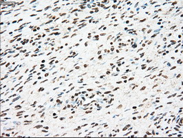 m00705 2 anti ssb mouse monoclonal antibody clone id oti2c8 ihc testing 4
