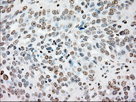 m00705 2 anti ssb mouse monoclonal antibody clone id oti2c8 ihc testing 5