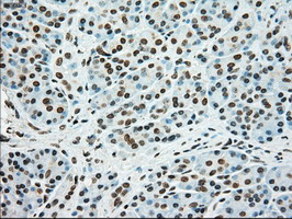m00705 2 anti ssb mouse monoclonal antibody clone id oti2c8 ihc testing 6