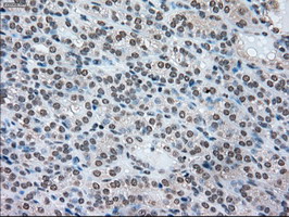 m00705 2 anti ssb mouse monoclonal antibody clone id oti2c8 ihc testing 7