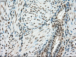 m00705 2 anti ssb mouse monoclonal antibody clone id oti2c8 ihc testing 8