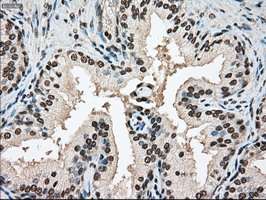m00705 2 anti ssb mouse monoclonal antibody clone id oti2c8 ihc testing 9
