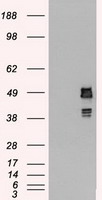 HEK293T cells were transfected with the pCMV6-ENTRY control (Left lane) or pCMV6-ENTRY SSB (Right lane) cDNA for 48 hrs and lysed
