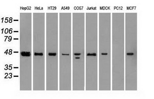 Western blot analysis of extracts (35ug) from 9 different cell lines by using anti-SSB monoclonal antibody