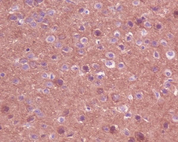 m00706 ihc