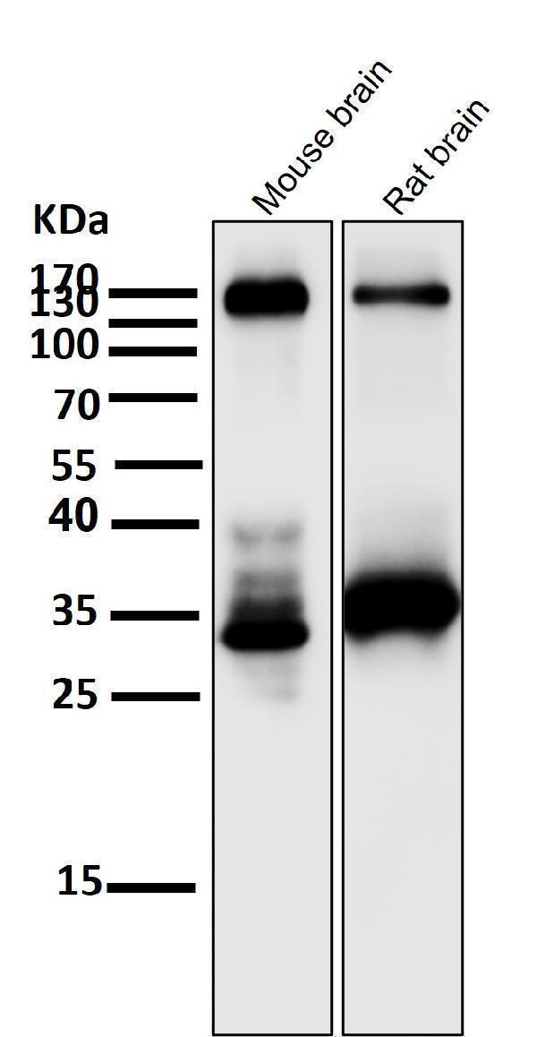 All lanes use the Antibody at 1:2K dilution for 1 hour at room temperature