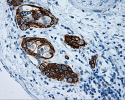 m00712 1 anti mcl1 mouse monoclonal antibody clone id oti10f6 ihc testing 3